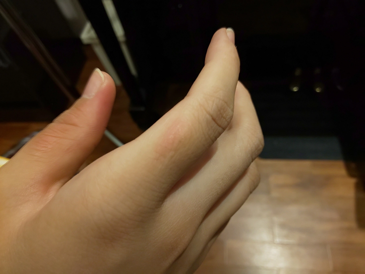 トリルキーに当たって赤くなった右手人指し指