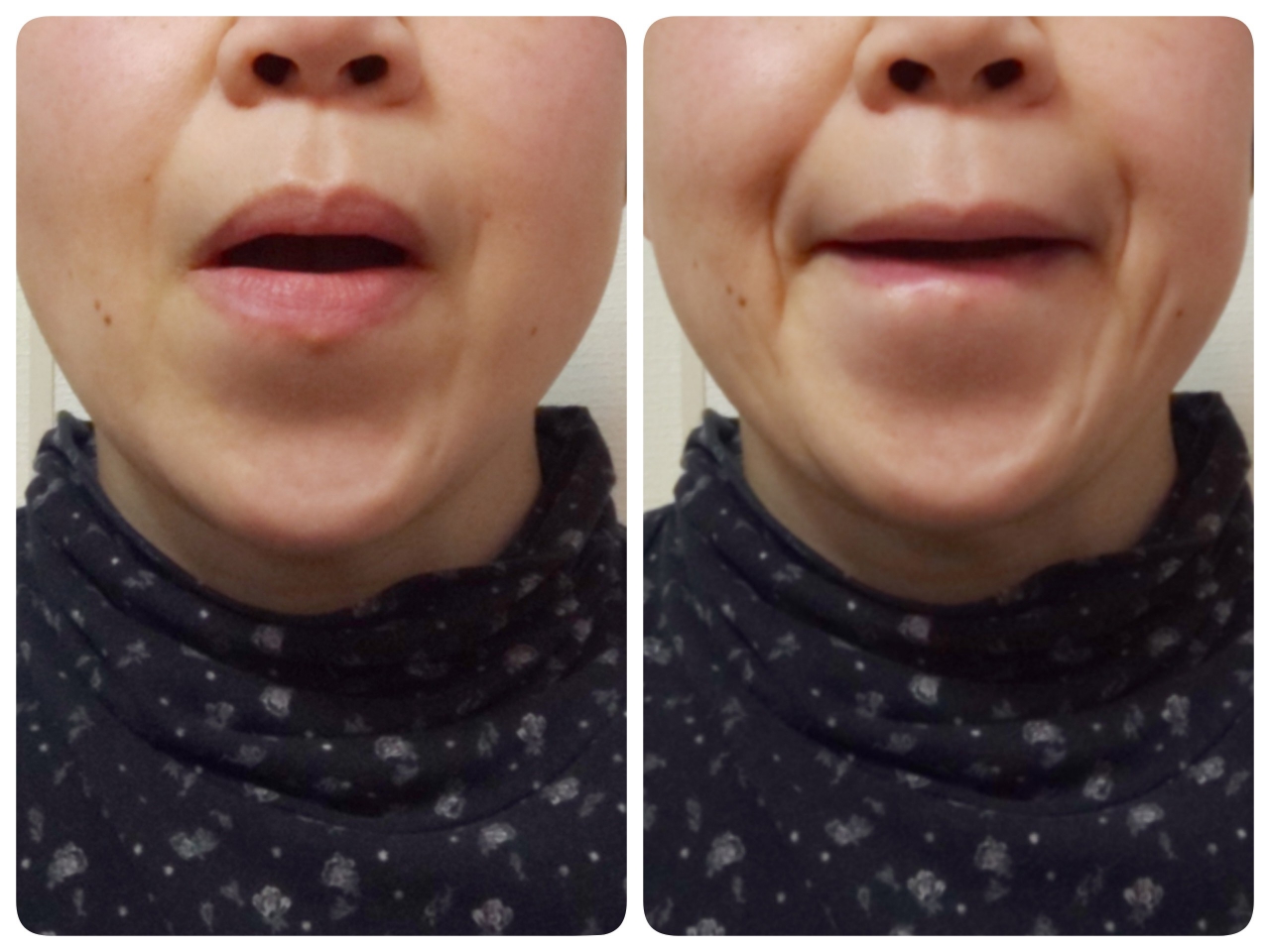 正面から見たあごの引き方の比較