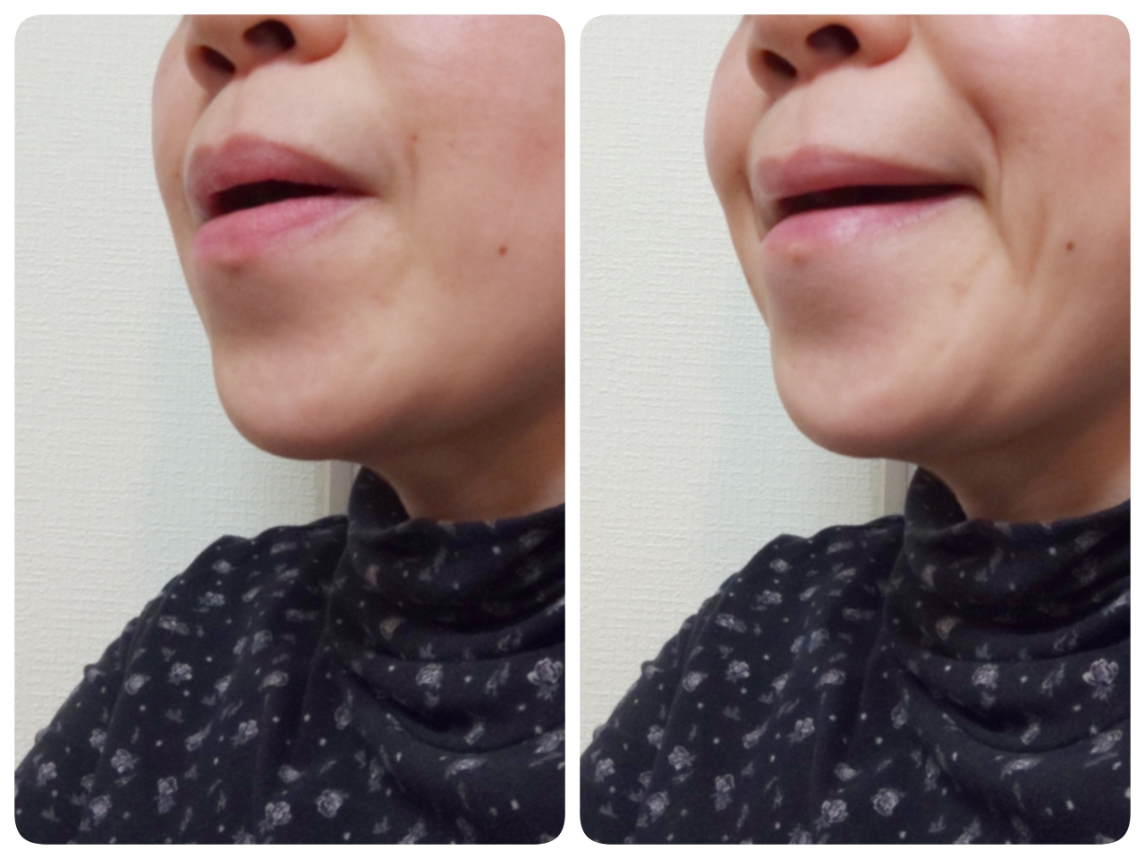 斜めから見たあごの引き方の比較